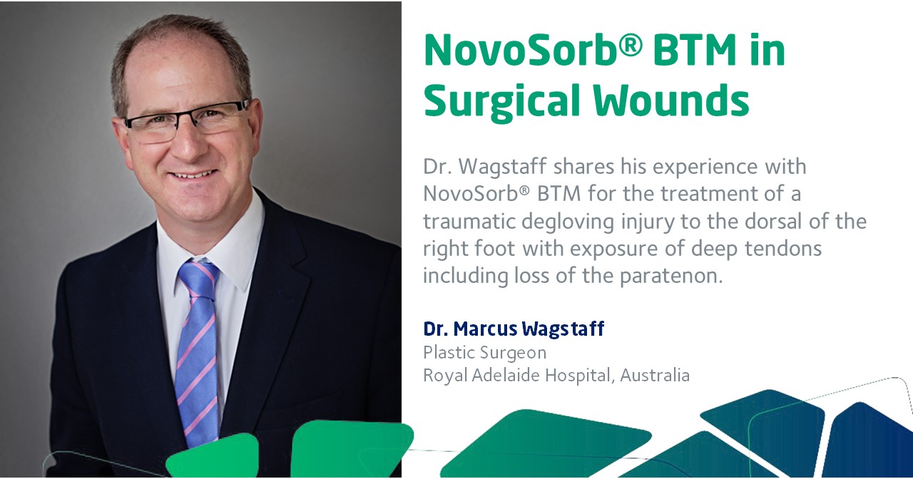 Wagstaff Image
