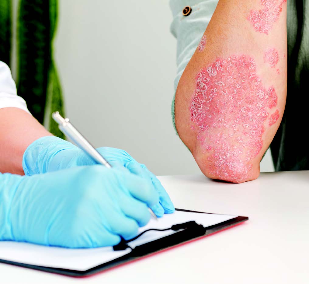 Skin Rash Documentation Example On-Point Documentation