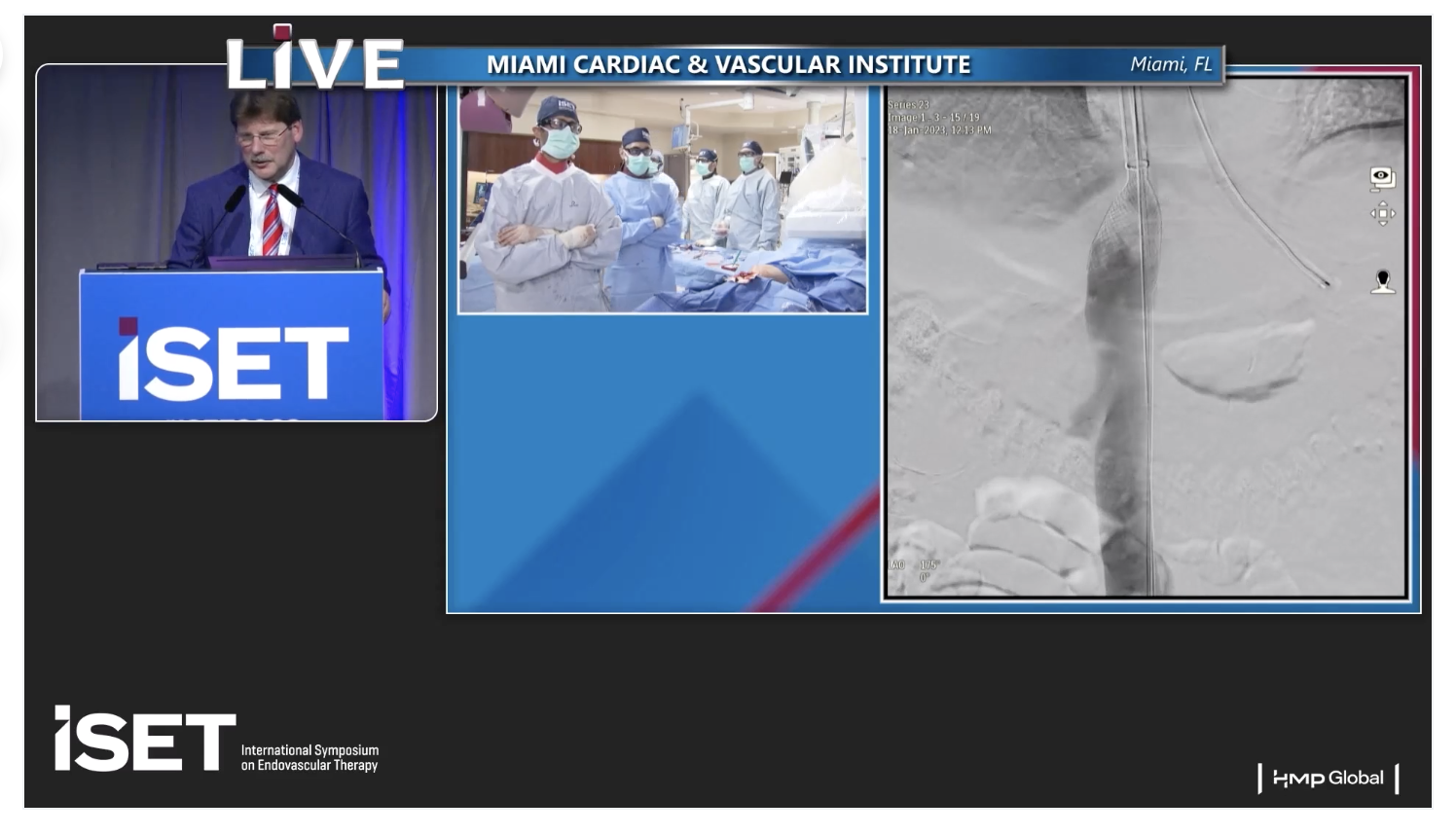 Protrieve Sheath Inari Inari Medical's Protrieve and ClotTriever | VDM