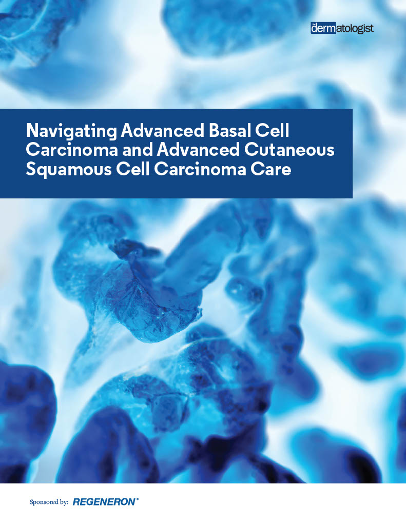 Navigating Advanced Basal Cell Carcinoma and Advanced Cutaneous ...