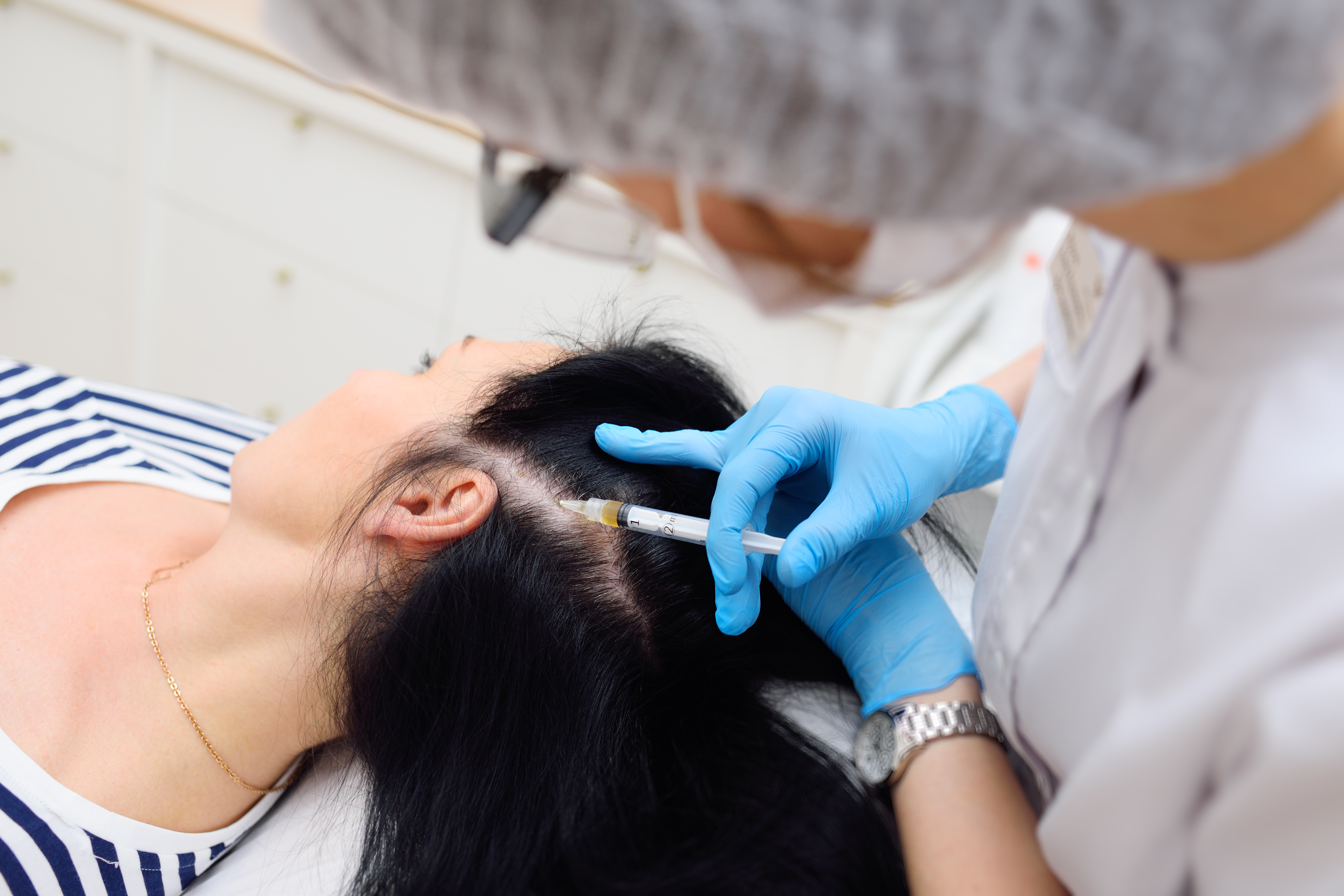 Alopecia + Treatment