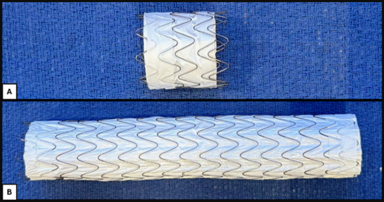 Figure 4. (A) GORE TAG Thoracic Branch Endoprosthesis Extender 