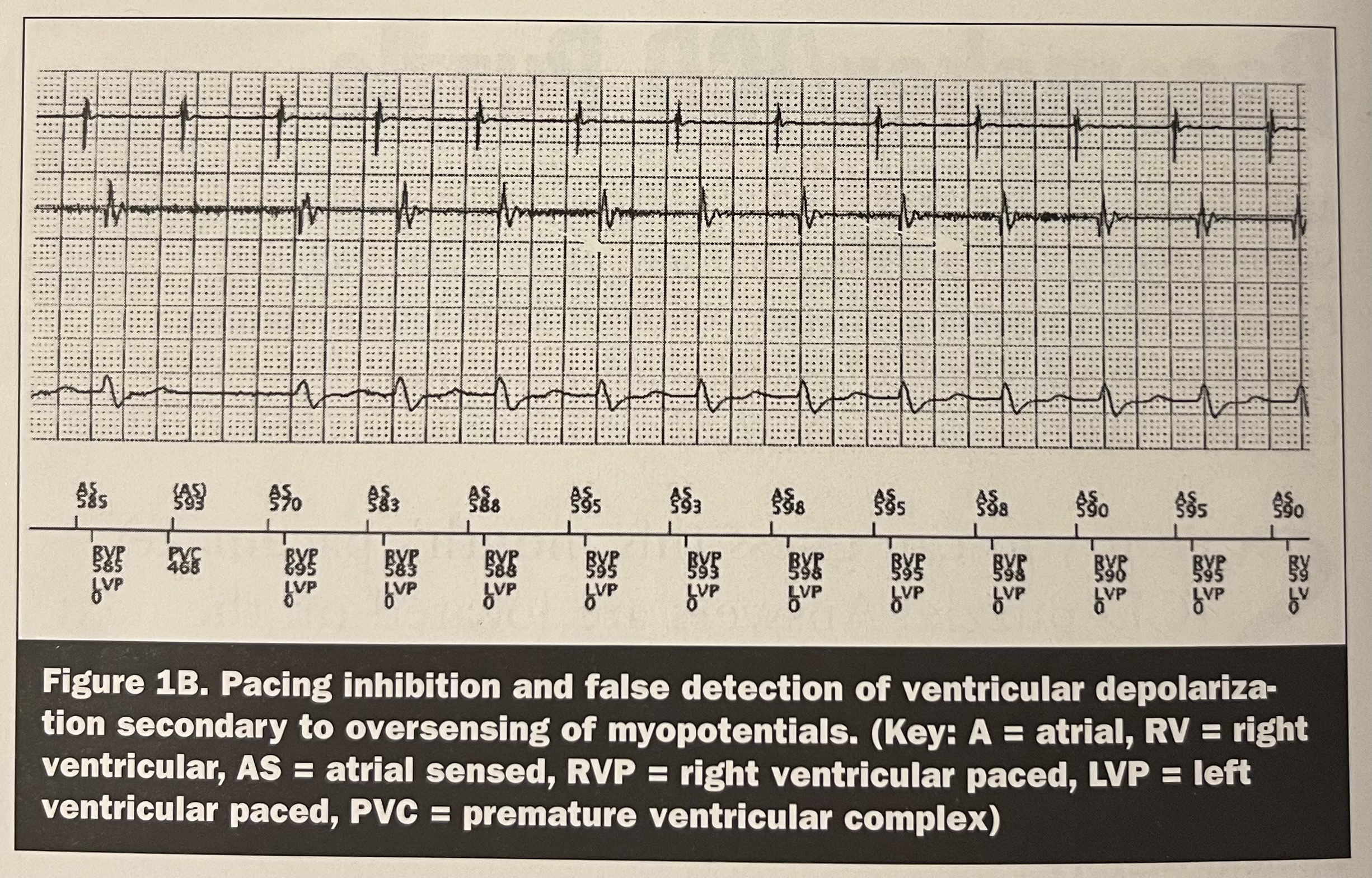 Figure 1B answer