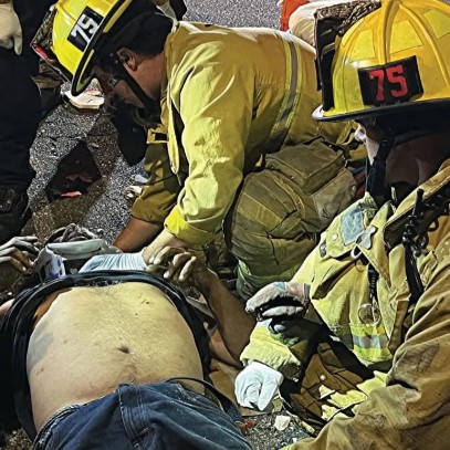 The chest of a trauma victim is rapidly assessed for flail segments. (Photo: Rick McClure) 