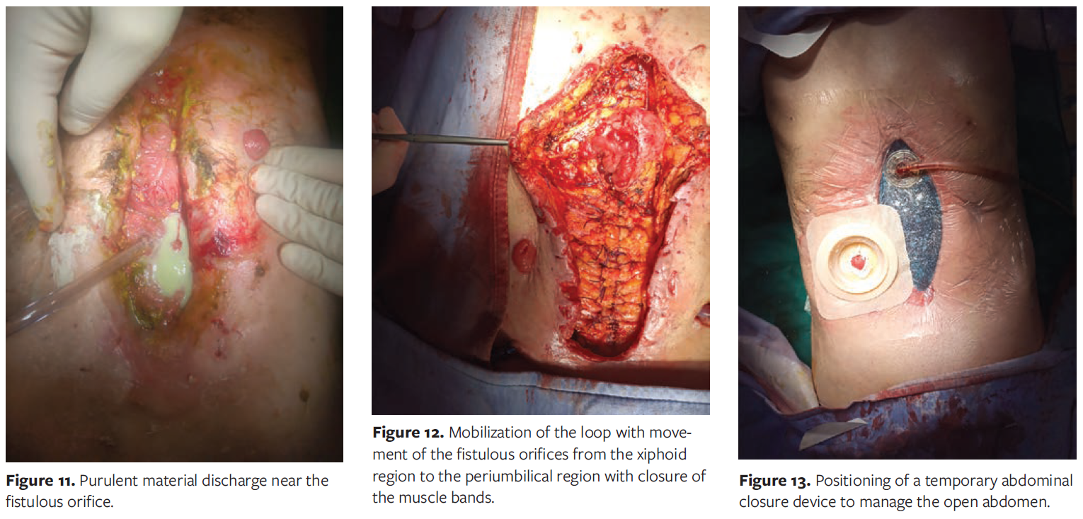 Figures 11 12 and 13