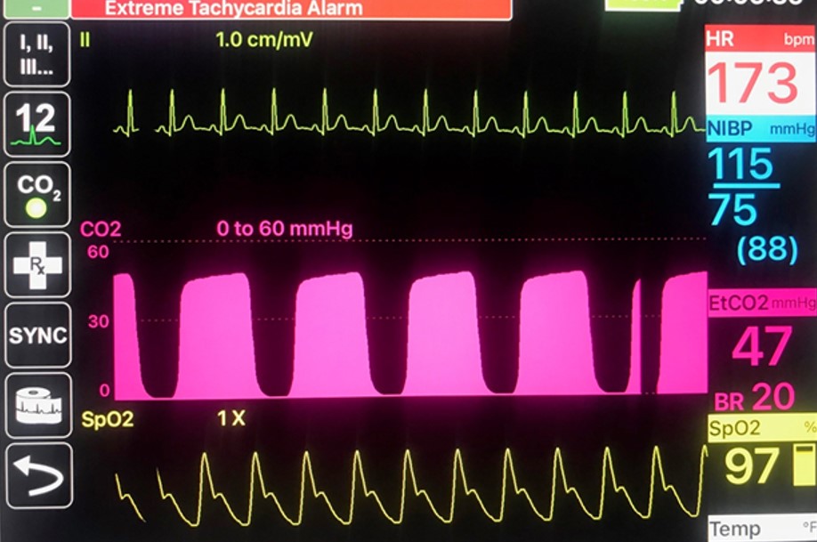 Figure 1: Monitor display (Image: MCHD EMS) 