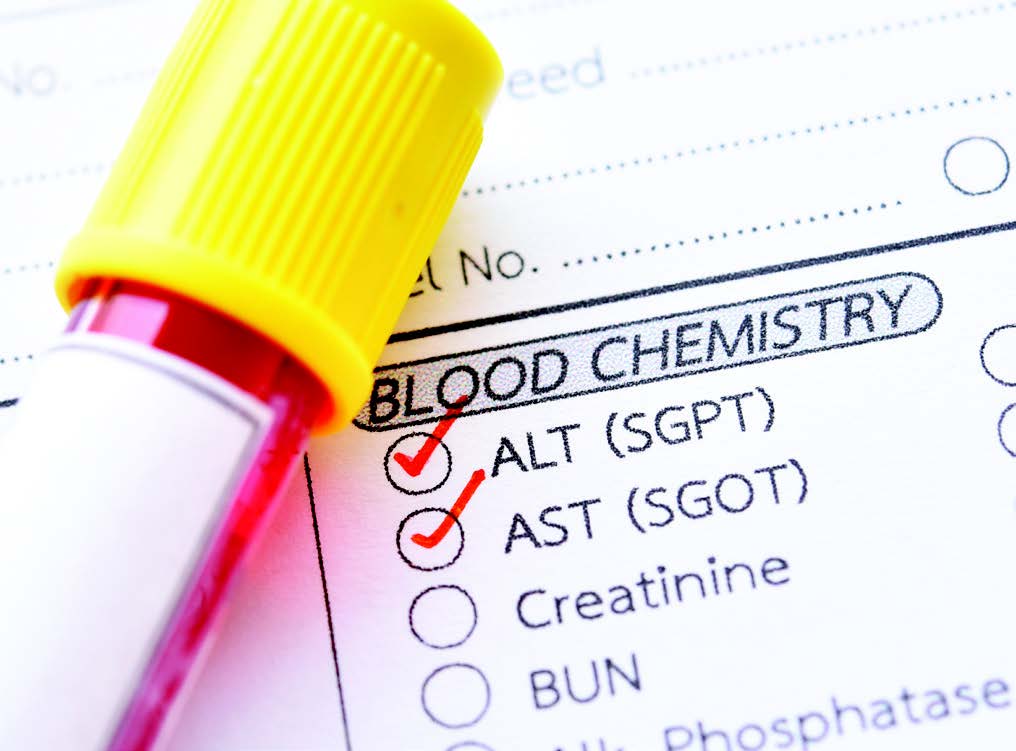 Useful Blood Work Timing With Isotretinoin