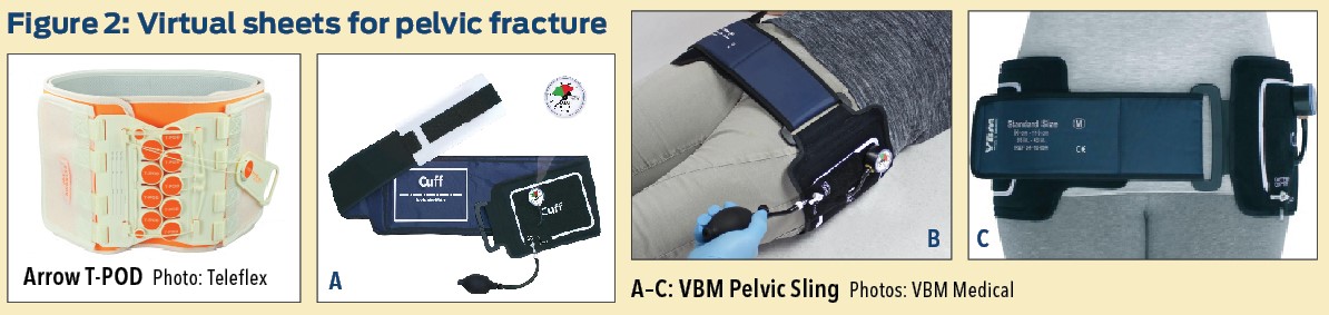 Figure 2: Virtual Sheets for Pelvic Fracture