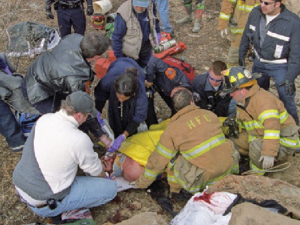 Bone is vascular, sometimes very much so. This is obviously a good thing for the patient who needs the white and red cells supplied by the bone to live, but not so much for the EMS providers who must learn to stop bleeding from hard vascular structures that cannot be clamped or controlled with pressure. (Photo: Craig Jackson) 