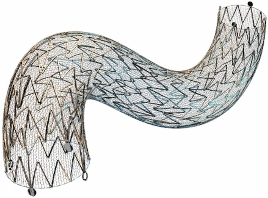 Fig. 2. The CGuard micromesh covered carotid stent.