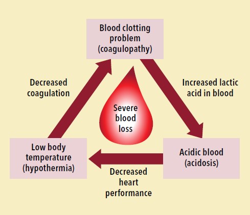 Figure 1: Trauma’s lethal triad