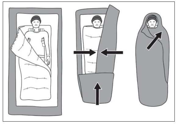 Figure 3: Hypothermia (“burrito”) wrap  (Image: Baedr-9439/Wikimedia Commons)