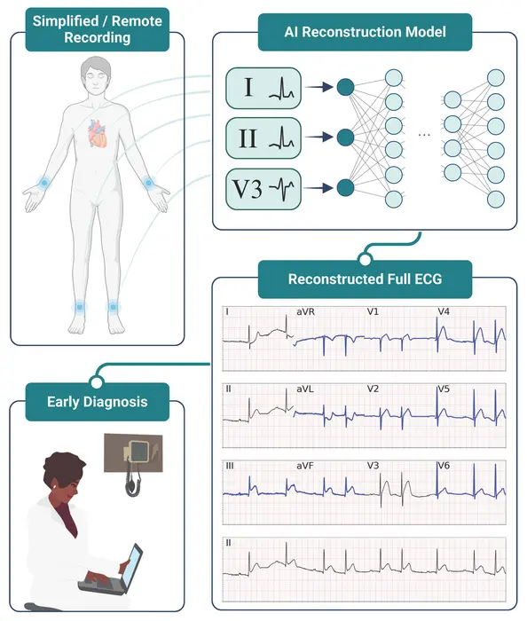 Scientists and clinicians at Scripps Research have shown that heart conditions can be diagnosed roughly as accurately using just three electrodes and an artificial intelligence (AI) tool.  CREDIT Scripps Research