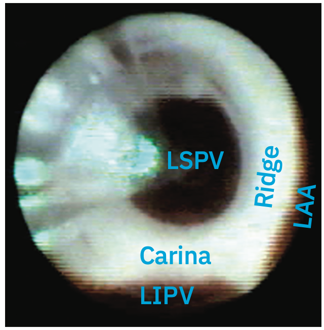 Acevedo-Phan HeartLight X3 Figure 2