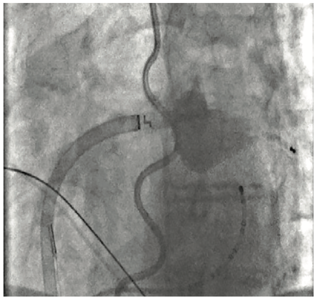 Acevedo-Phan HeartLight X3 Figure 3