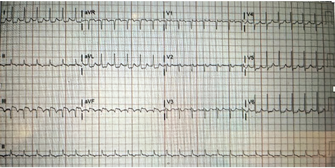 Agrawal - Fig 1 - CLD Jan 2025