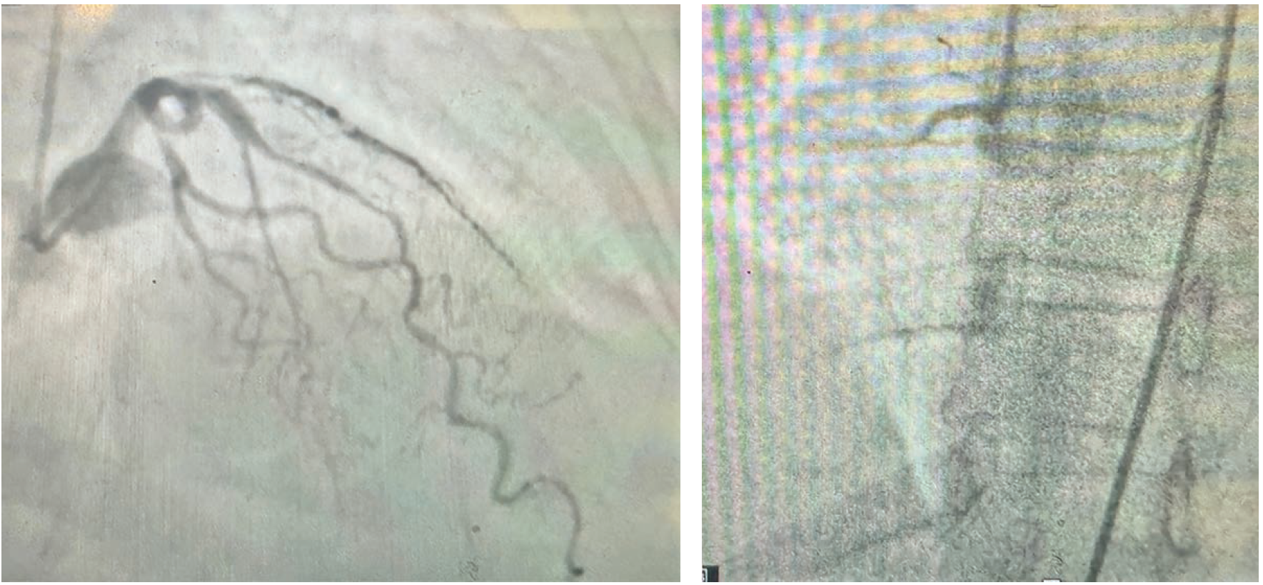 Agrawal - Fig 2 - CLD Jan 2025