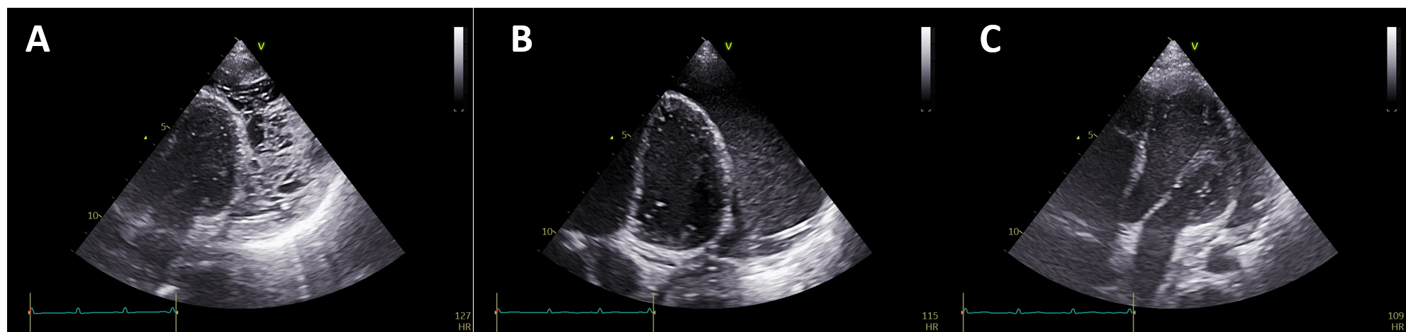 Figure 1. Transthoracic echocardiography