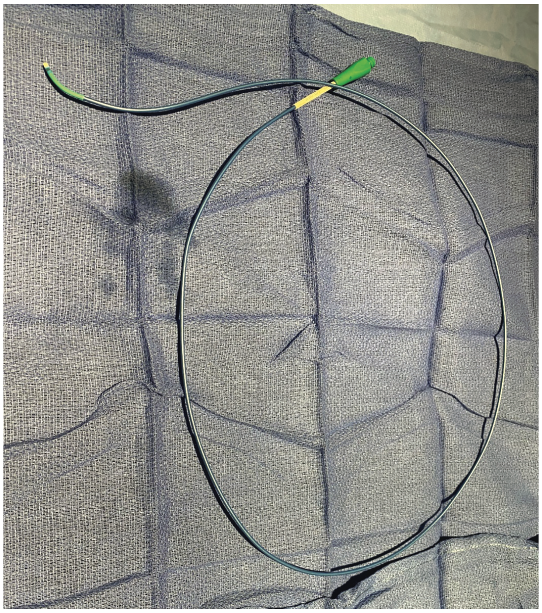 Ajmal Aortic Pressure Gradient Figure 1