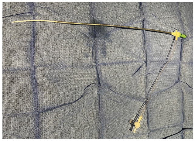 Ajmal Aortic Pressure Gradient Figure 2