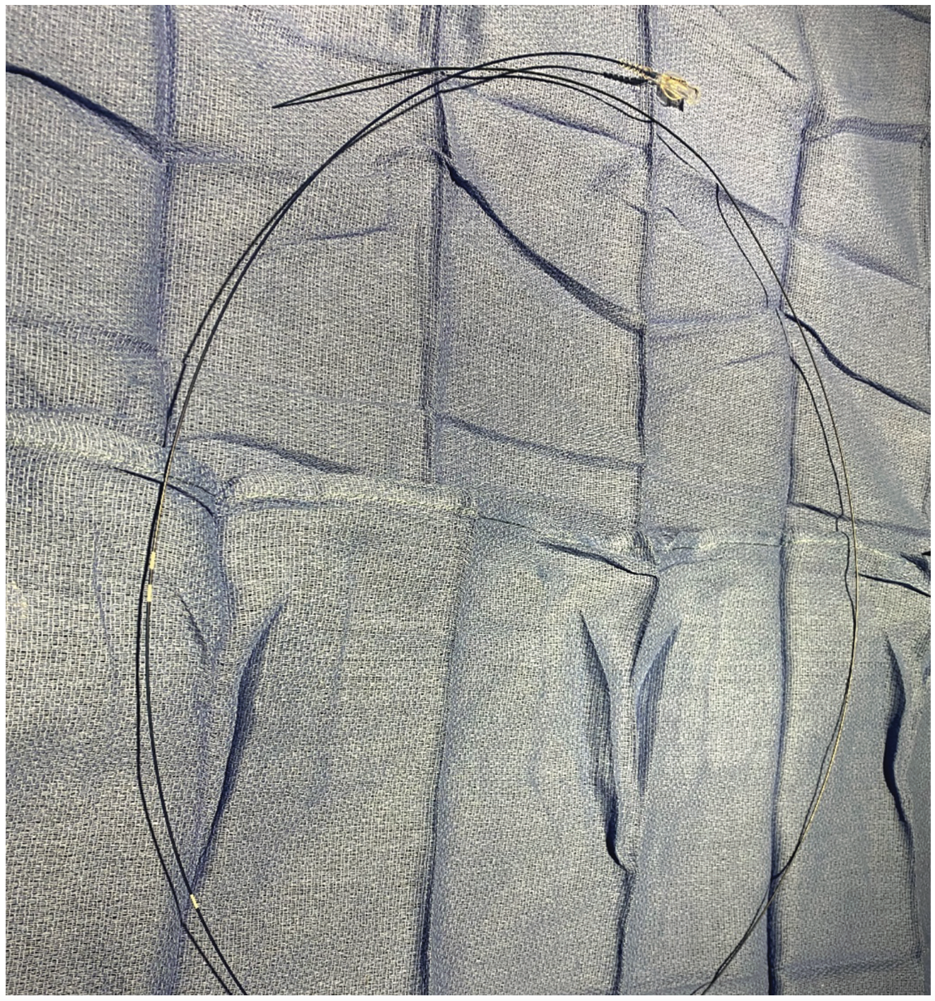 Ajmal Aortic Pressure Gradient Figure 3