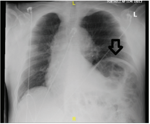 Ali - Fig 1 - JanFeb 2026.png 