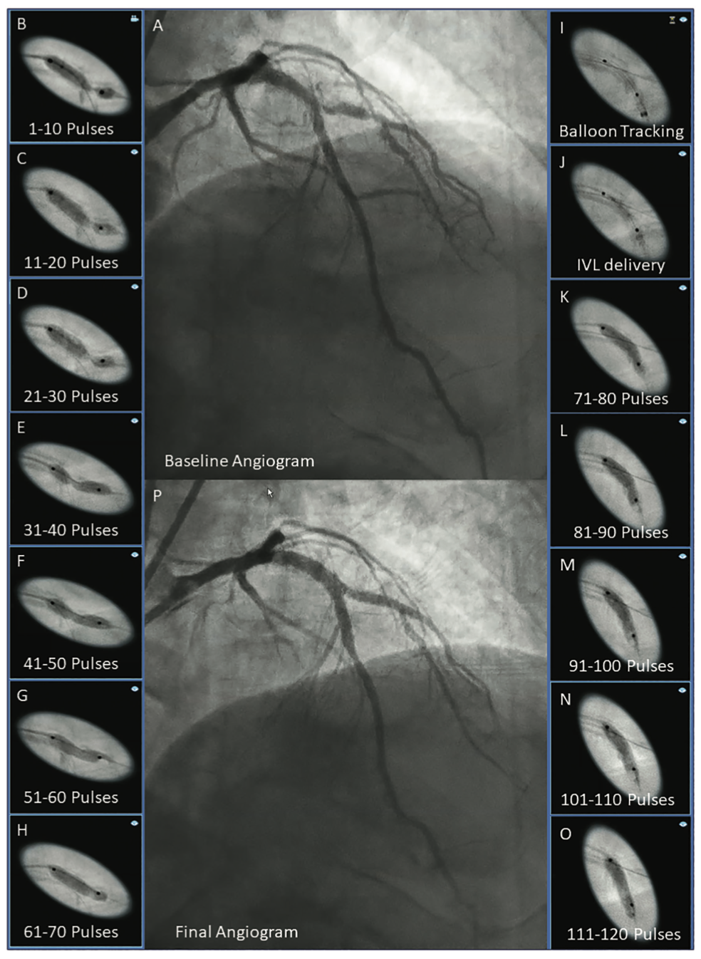 Ali Shockwave Figure