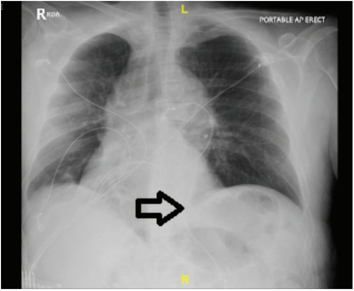 Ali-Fig4-JanFeb 2026.png 