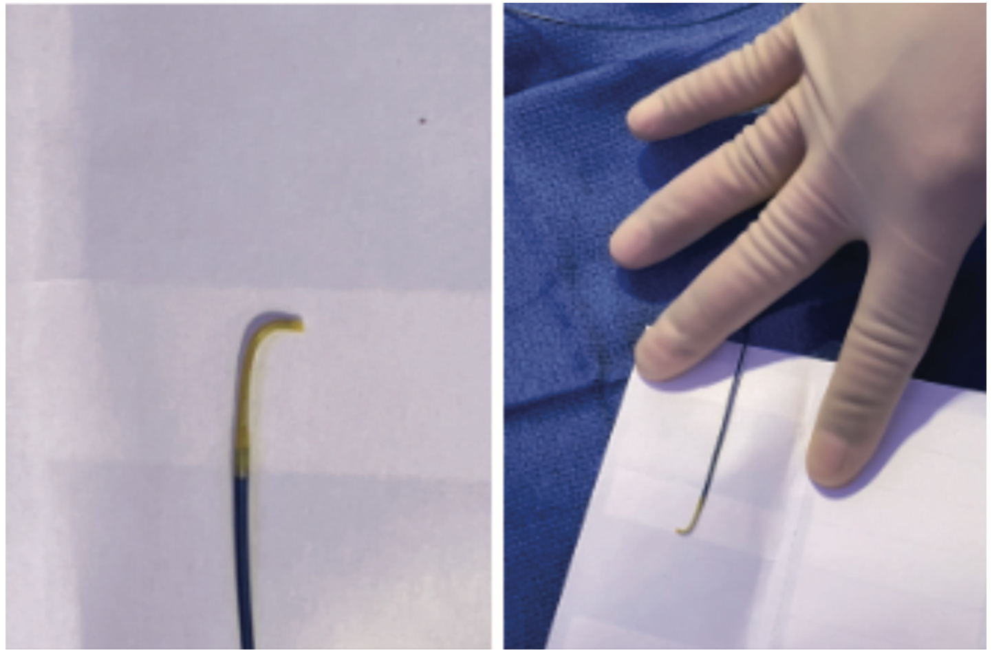 AliBailey Infrapopliteal Figure 5