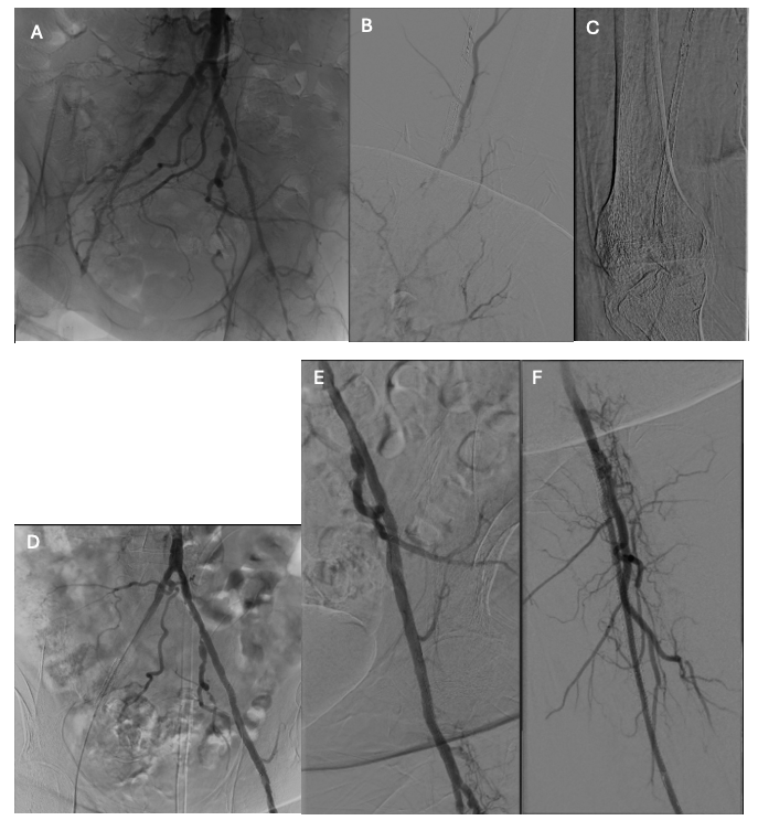 Figure 1 A-F