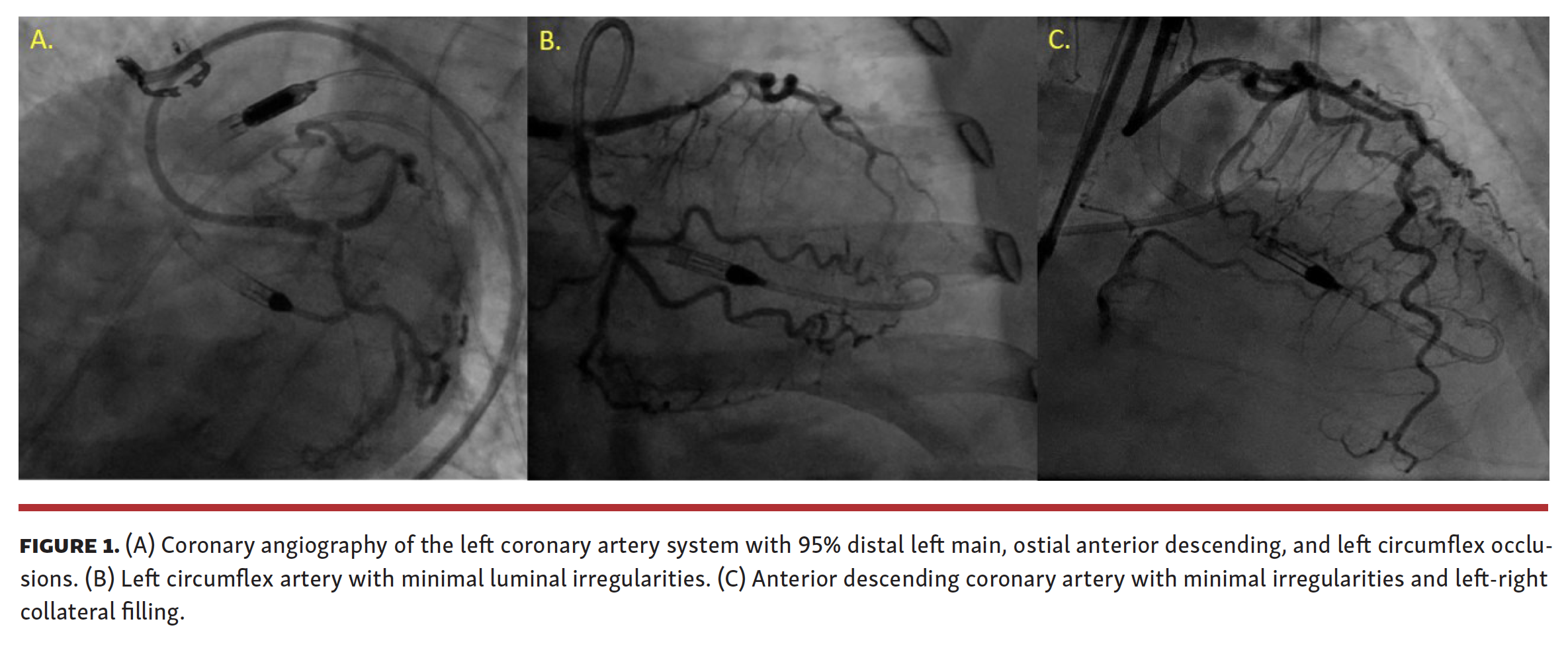 Alrayes Failed Manta Closure Device Fig 1