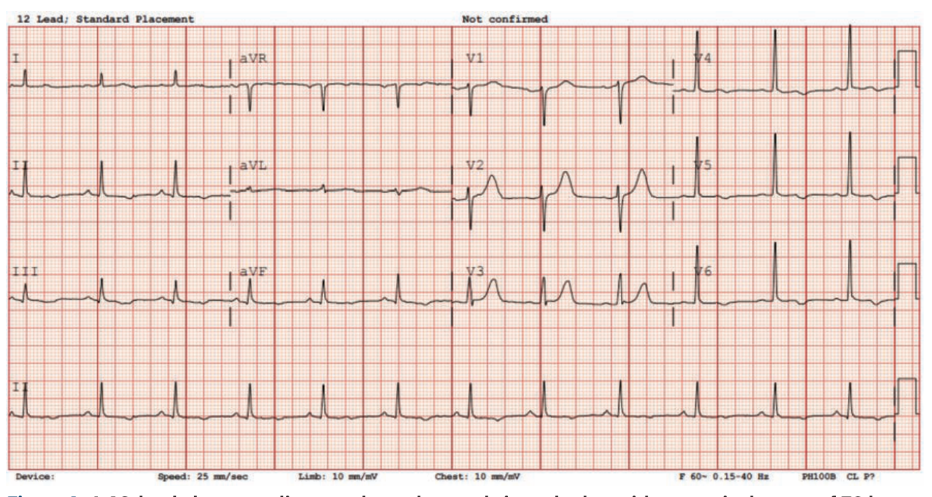 Alzayer Acute Coronary Syndrome Figure 1