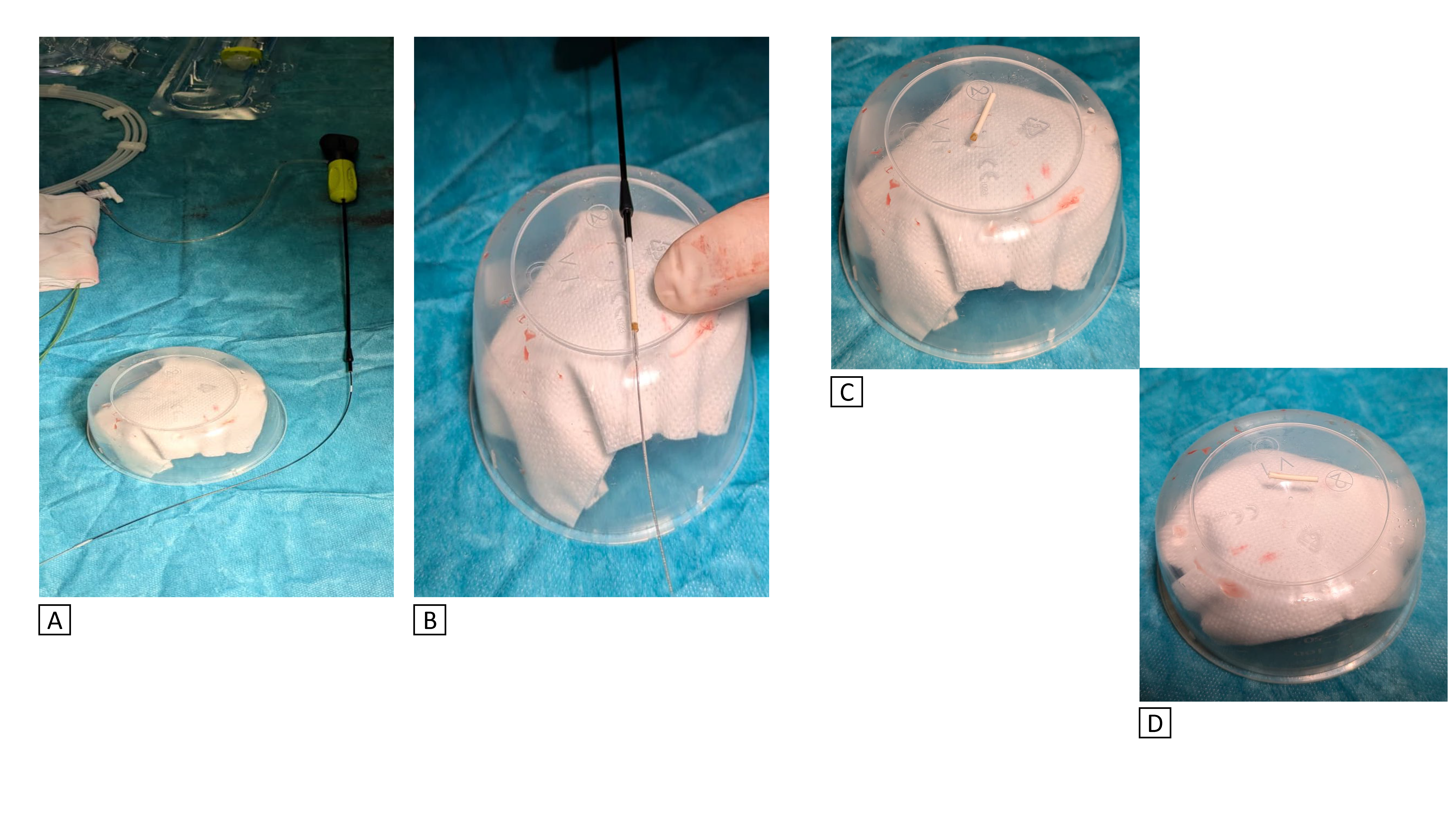 Figure 1. Device preparation