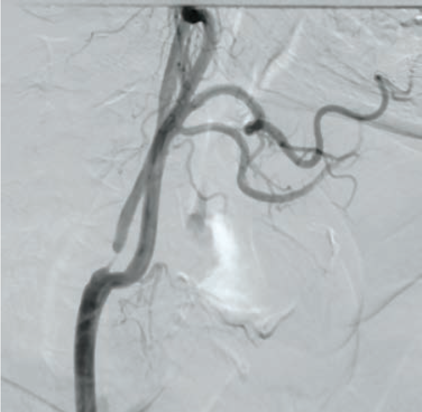 Anjum-Fig 1-CLD-Aug 2025.png 