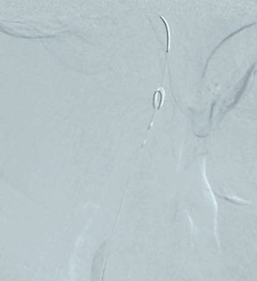 Anjum-Fig 2-CLD-Aug 2025.png 