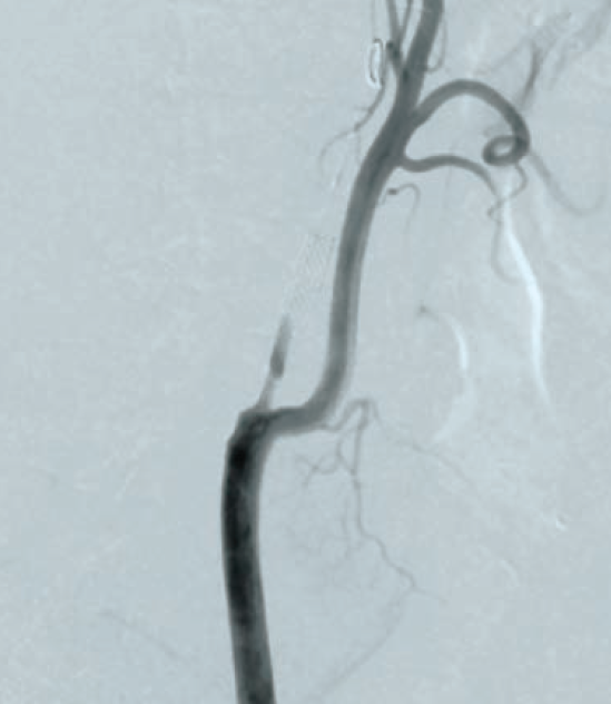 Anjum-Fig 4-CLD-Aug 2025.png 