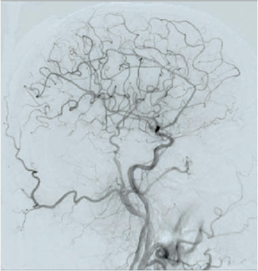 Anjum-Fig 8b-CLD-Aug 2025.png 