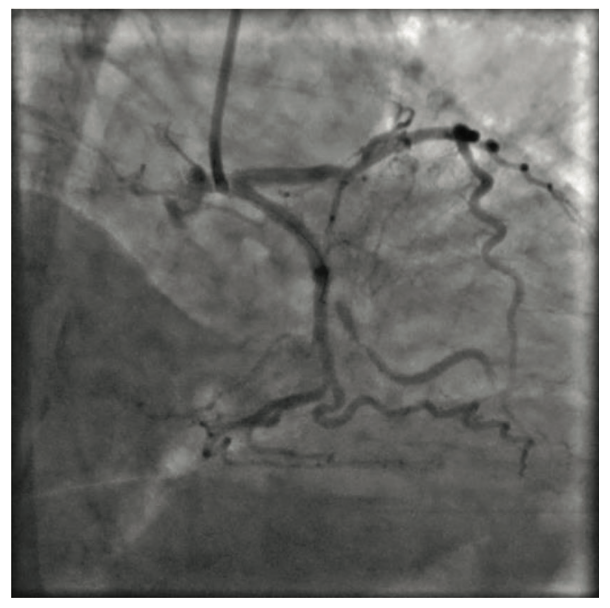 Anmar Wire Surfing Figure 1