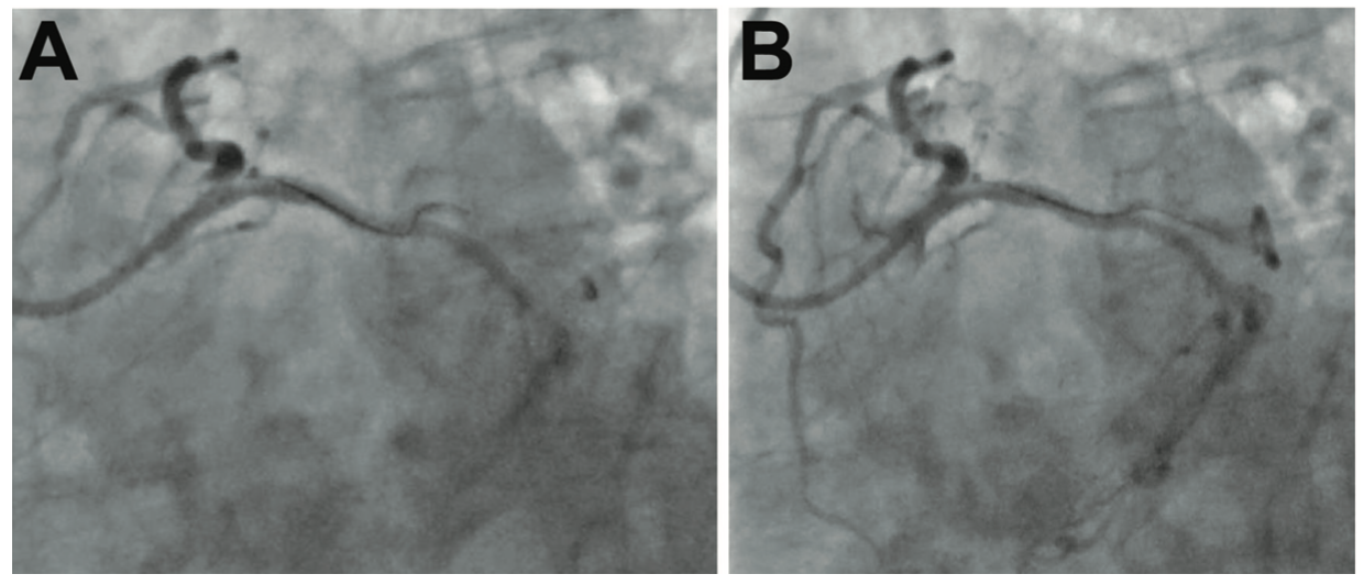 Anmar Wire Surfing Figure 2