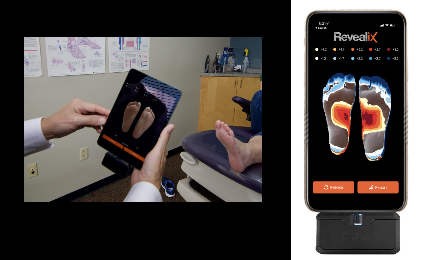 In these photos, one can see Smart Thermal (Revealix), a thermal imaging application for health care providers that measures plantar foot temperature. 