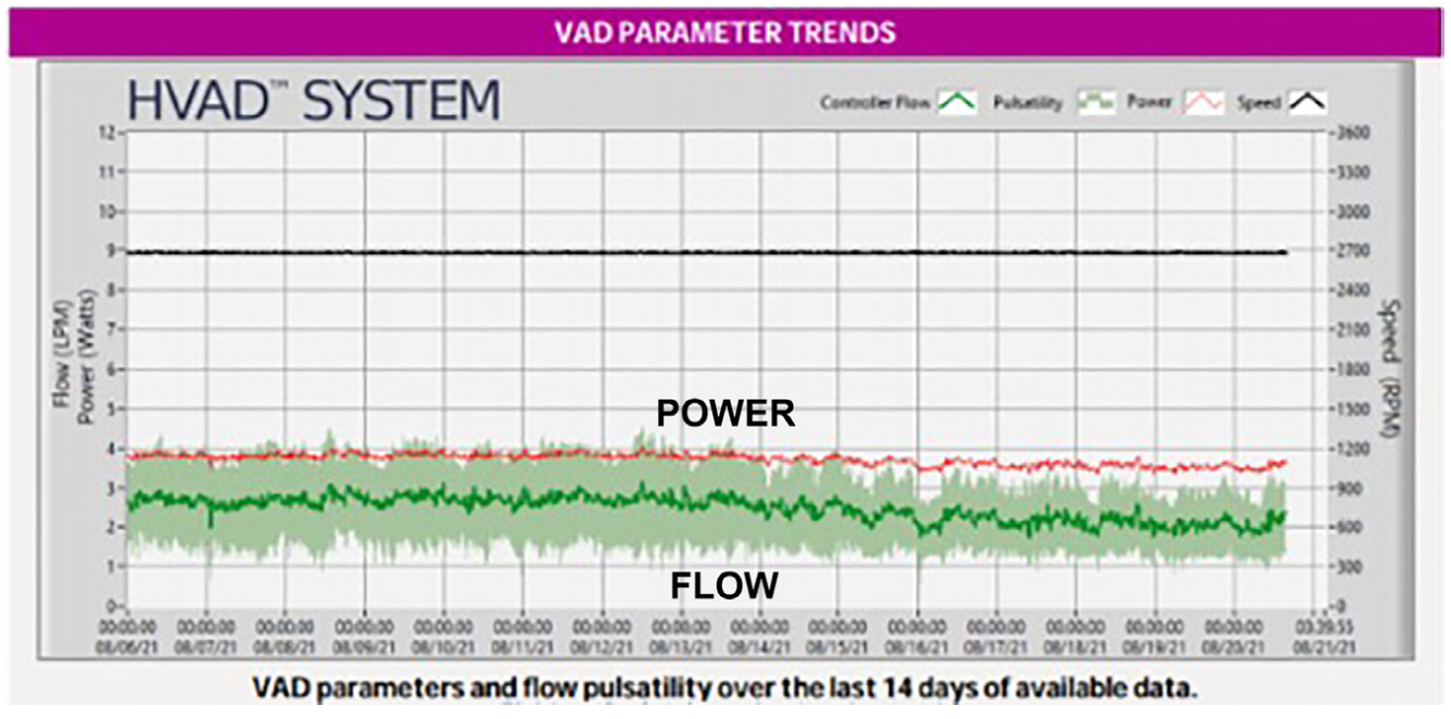 Araj Graft Obstruction Figure 2