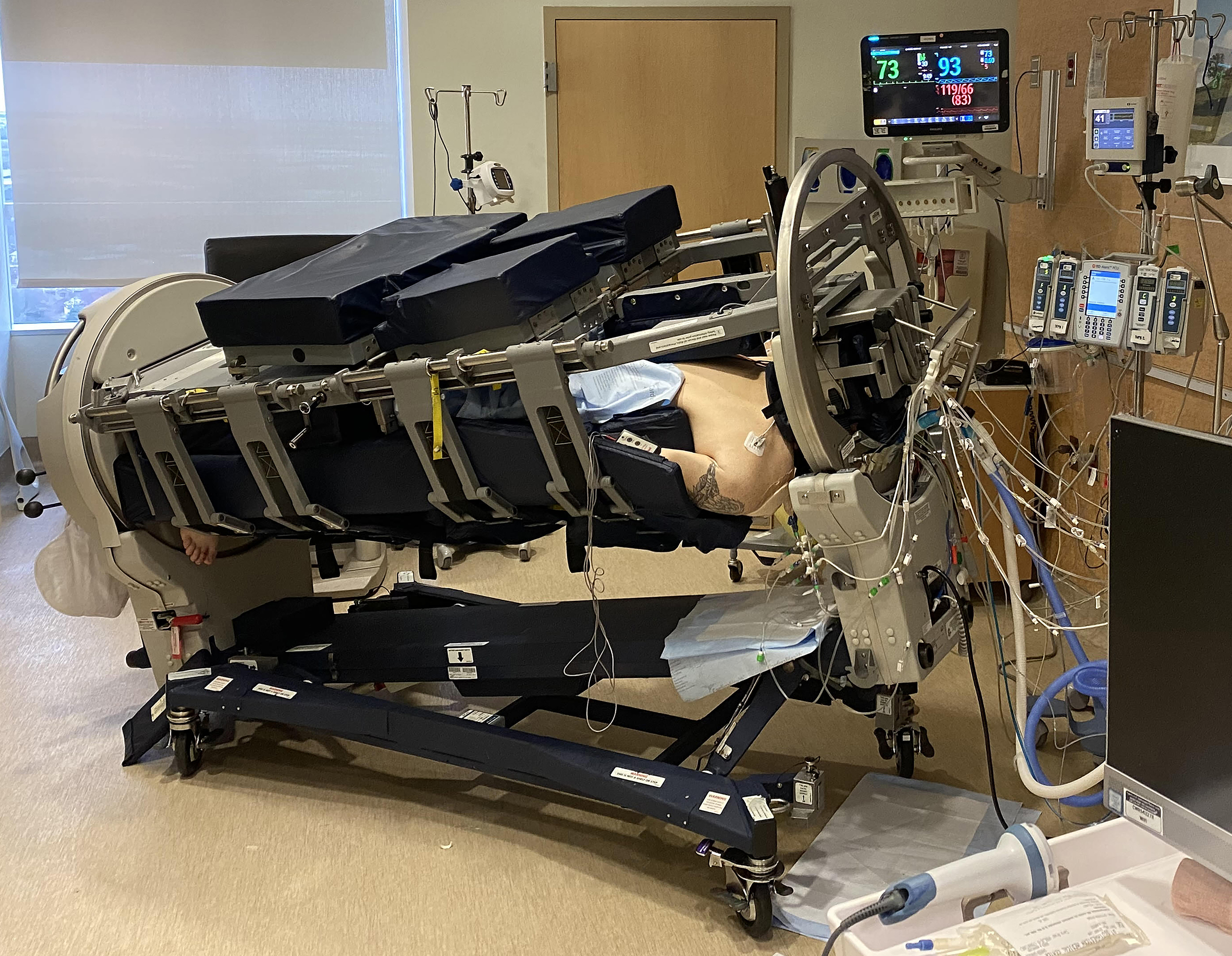 Figure. A patient with COVID-19 in the RotoProne system (Arjo)