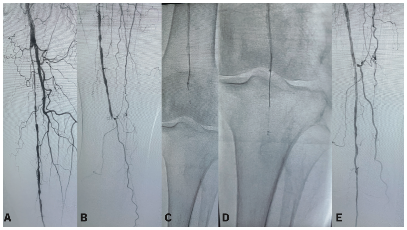 Armstrong Crosser iQ Figure 2