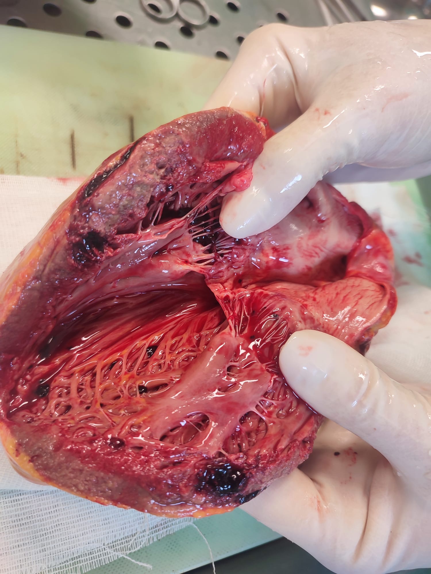 Figure 3. Long-axis cut of the heart.