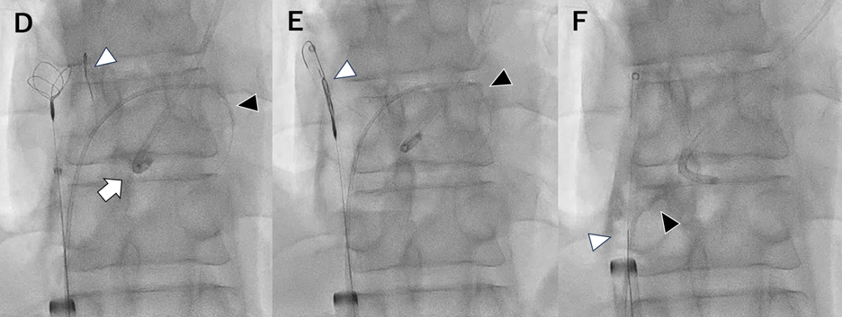 Figure D-F