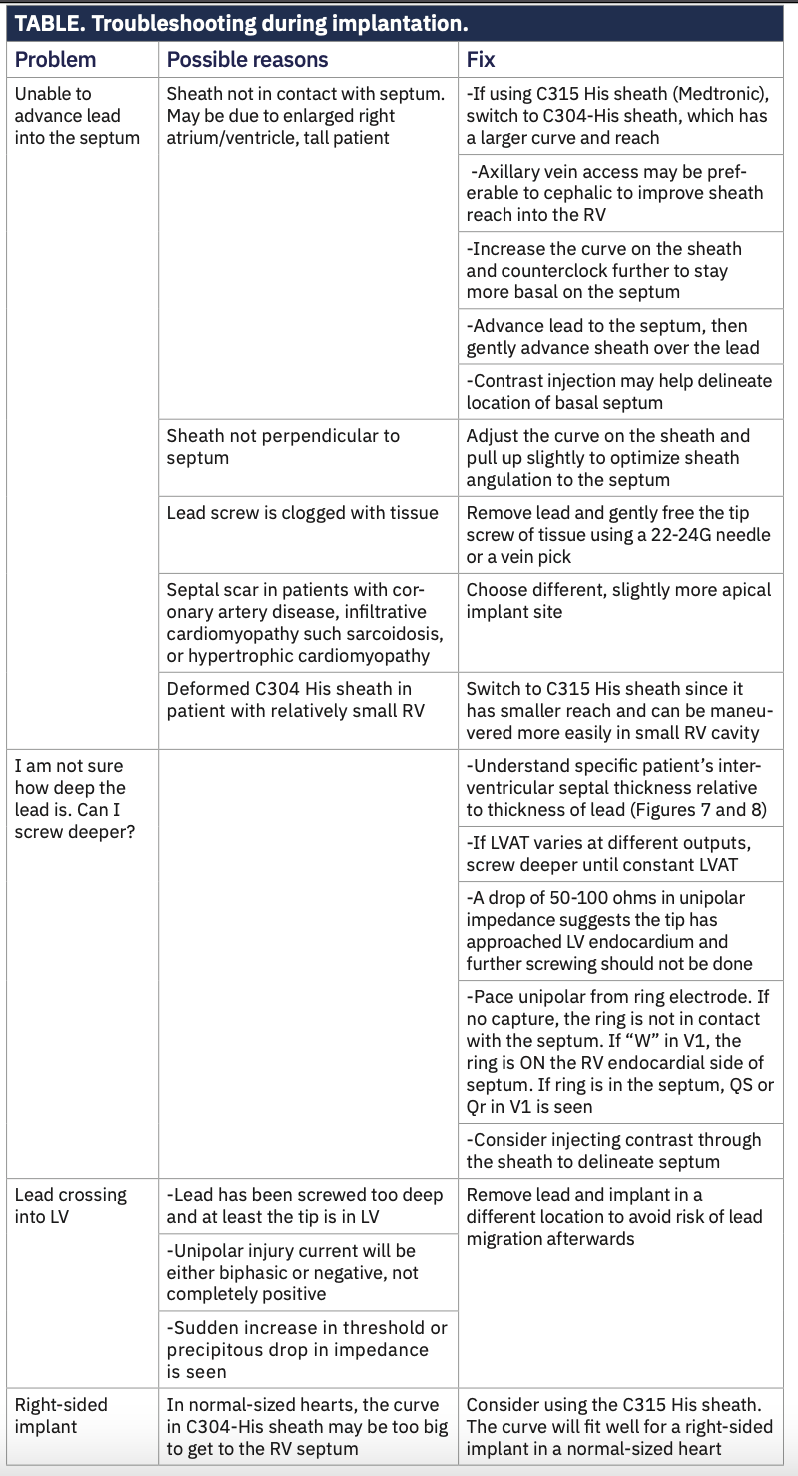 Ayinde Left Bundle Branch Table 1
