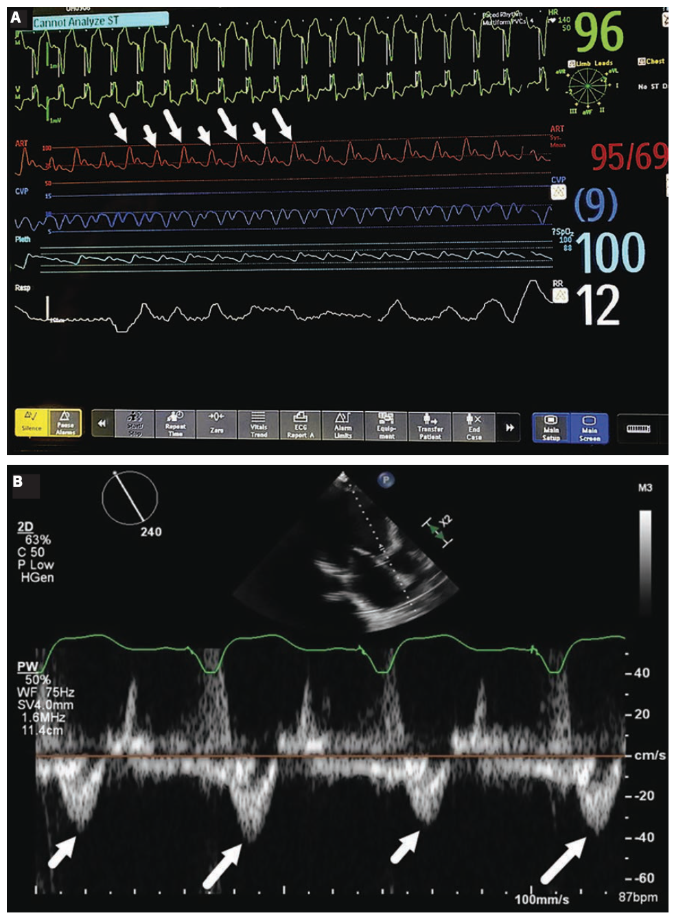 Beaini Traubes Figure 1