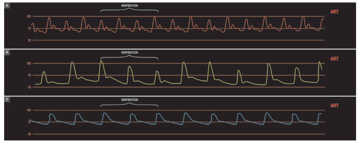 Beaini Traubes Figure 2