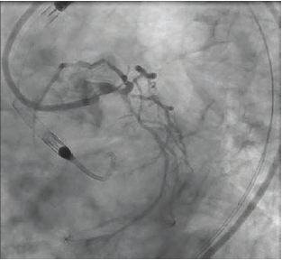 Bergmark Fig 1 July 2024