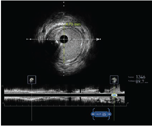Bergmark Fig 2 July 2024